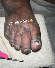 Load image into Gallery viewer, Callus Soak